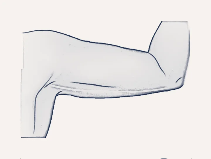 Sketch: the arm afterwards