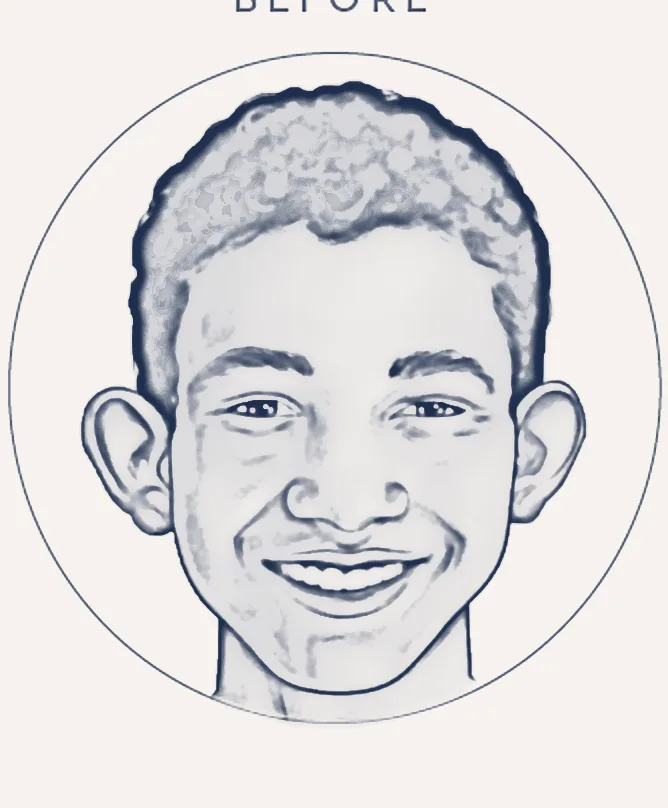 Sketch: prominent ears