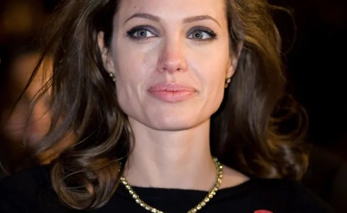Προληπτική μαστεκτομή Angelina Jolie