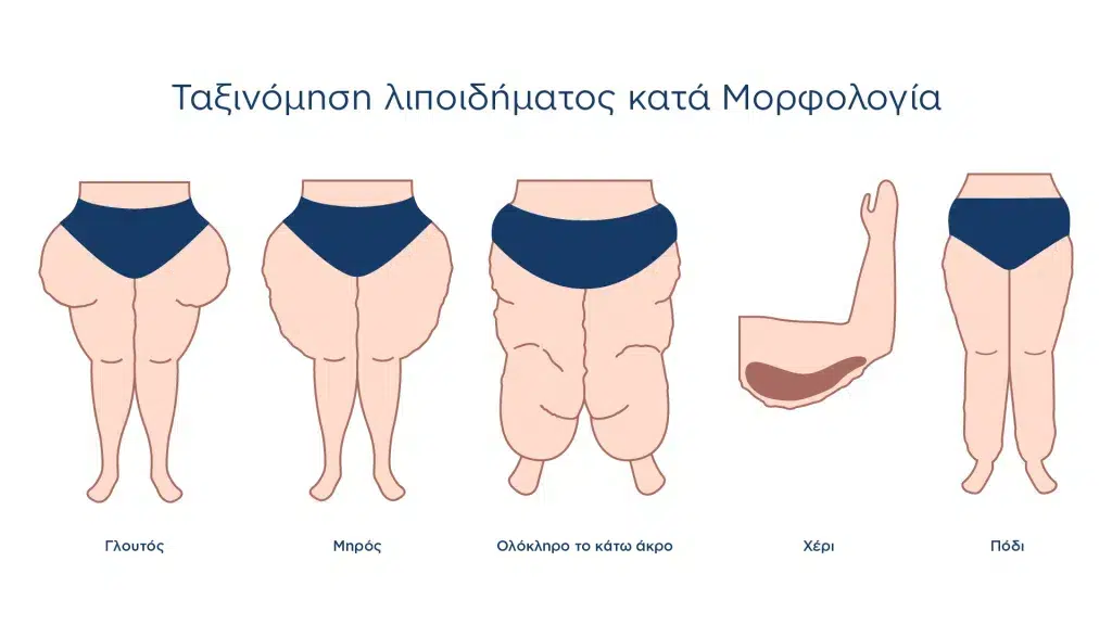 lipoanarofisi perioxes efarmogis 1024x576 1.png 1